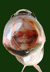 I Know That THESE Mouth Problems are NOT from Vitamin D Deficiency!
