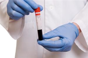 Gluten Sensitivity Testing May Not be Accurate
