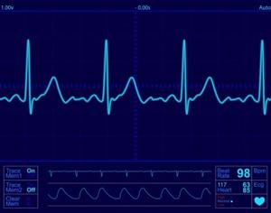 Vitamin d and the heart are intimately connected